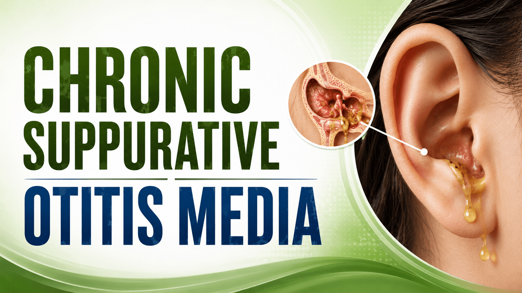Chronic Otitis Media