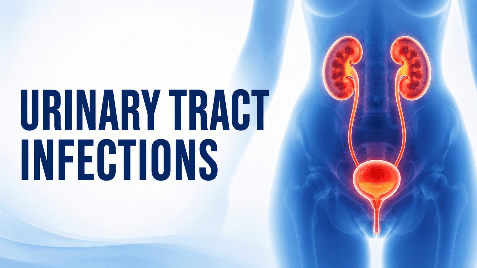 Urinary Tract Infections