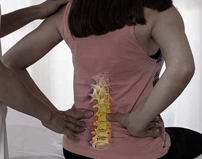 Sciatica