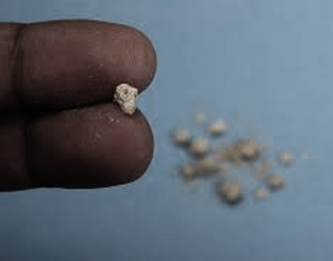 Kidney Stones treatment placeholder